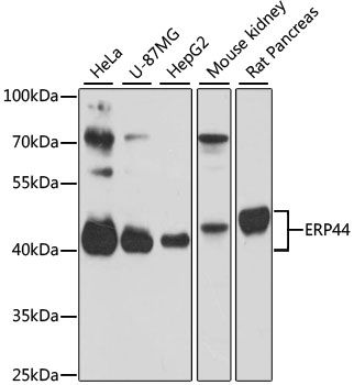 Western blot - ERP44 antibody (144-61389)