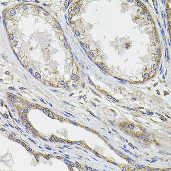 Immunohistochemistry - UBE2S antibody (144-04658)