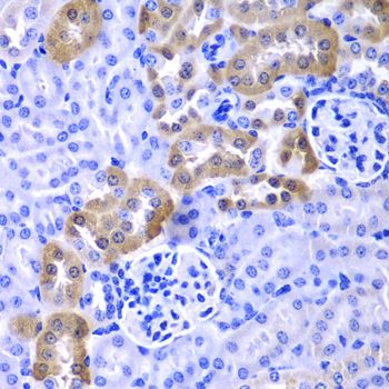 Immunohistochemistry - LAMP1 Polyclonal Antibody (144-02582)