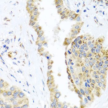 Immunohistochemistry - DARS2 antibody (144-07813)