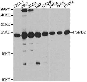 Western blot - PSMB2 antibody (144-013630)