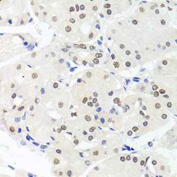 Immunohistochemistry - HMGN1 Polyclonal Antibody (144-06155)