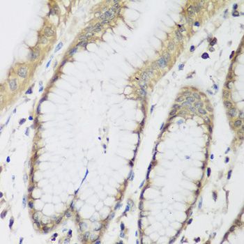 Immunohistochemistry - METTL7A antibody (144-08201)
