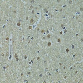 Immunohistochemistry - UBE2I Polyclonal Antibody (144-02193)