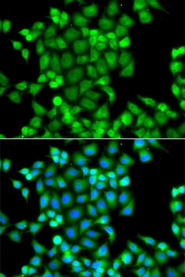 Immunofluorescence - PAK2 Polyclonal Antibody (144-07333)