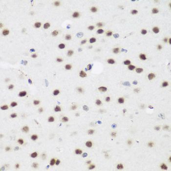 Immunohistochemistry - AEBP2 antibody (144-07400)