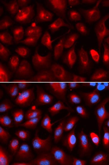Immunofluorescence - KLC1 antibody (144-05552)