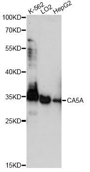 Western blot - CA5A antibody (144-60758)