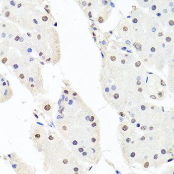 Immunohistochemistry - CHRAC1 antibody (144-07372)