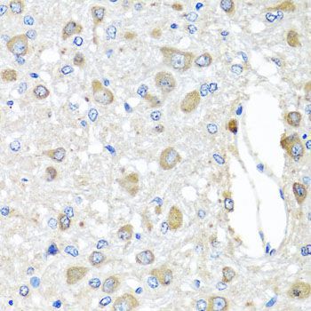 Immunohistochemistry - BAG5 antibody (144-05794)