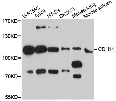 Western blot - CDH11 Polyclonal Antibody (144-08110)