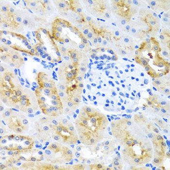 Immunohistochemistry - MOK antibody (144-01786)