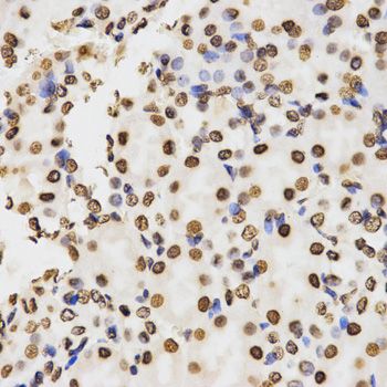 Immunohistochemistry - DiMethyl-Histone H3-K9 antibody (144-02359)