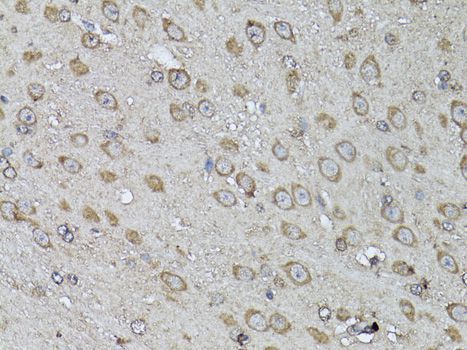 Immunohistochemistry - SNAI1 antibody (144-011794)
