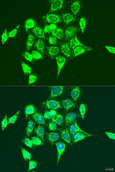 Immunofluorescence - RASGRP3 antibody (144-07791)