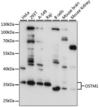 Western blot - OSTM1 antibody (144-011685)