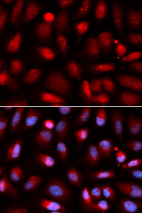 Immunofluorescence - RELA Polyclonal Antibody (144-02547)