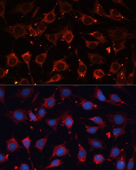 Immunohistochemistry - CASP3 Polyclonal Antibody (144-02156)