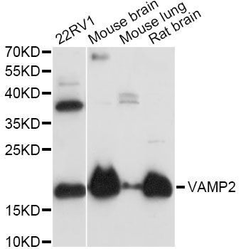 Western blot - VAMP2 Polyclonal Antibody (144-60082)