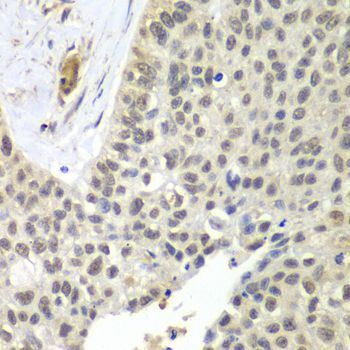 Immunohistochemistry - SNRPD2 Polyclonal Antibody (144-06983)