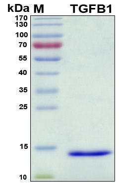 SDS-PAGE