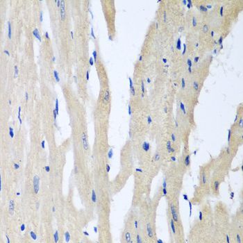 Immunohistochemistry - PITRM1 antibody (144-08362)