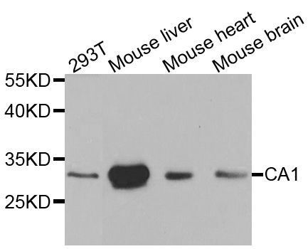 Western blot - CA1 Polyclonal Antibody (144-01031)