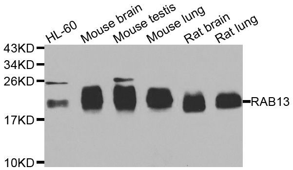 Western blot - RAB31 Polyclonal Antibody (144-07506)