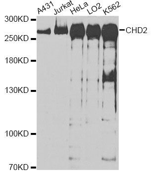 Western blot - CHD2 antibody (144-60353)