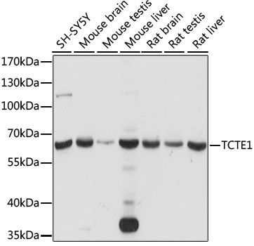 Western blot - TCTE1 antibody (144-015216)