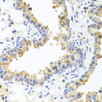 Immunohistochemistry - HSPA6 antibody (144-07688)