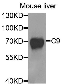 Western blot - C9 antibody (144-05622)