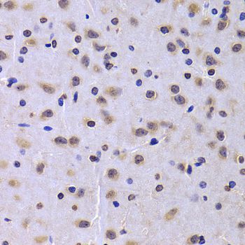 Immunohistochemistry - NUDC antibody (144-06678)