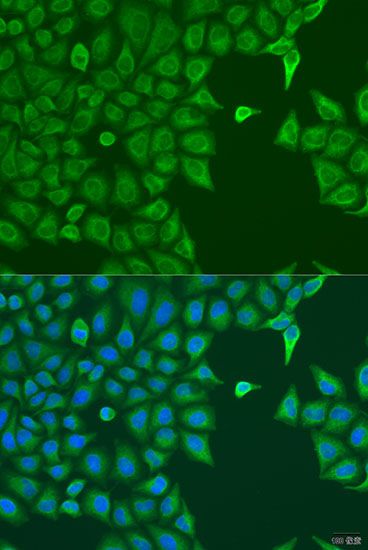 Immunofluorescence - POP7 antibody (144-08183)