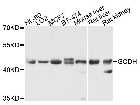 Western blot - GCDH antibody (144-09057)