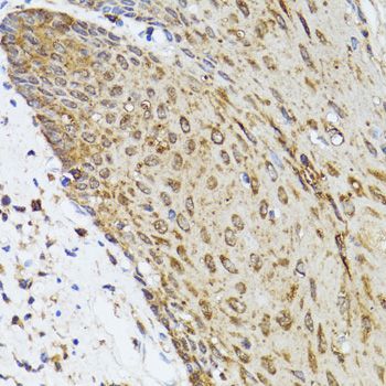 Immunohistochemistry - TOLLIP antibody (144-02202)