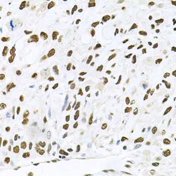 Immunohistochemistry - MAPK8 Polyclonal Antibody (144-00288)