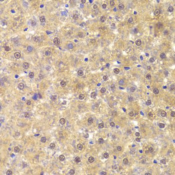 Immunohistochemistry - ANP32A Antibody (144-05768)