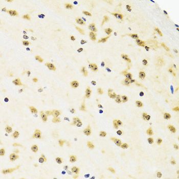 Immunohistochemistry - [KO Validated] SUZ12 Polyclonal Antibody (144-07786)