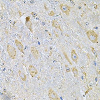 Immunohistochemistry - TXNDC5 Antibody (144-014152)