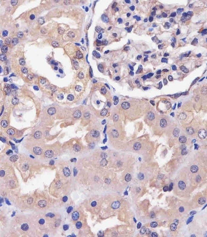 IHC-P