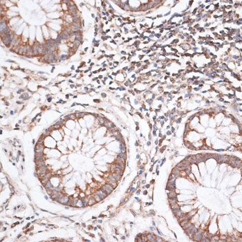 Immunohistochemistry - KIF14 Polyclonal Antibody (144-10275)