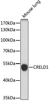 Western blot - CRELD1 antibody (144-015186)