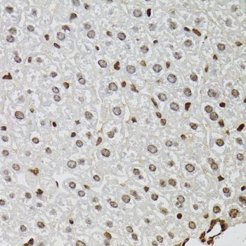 Immunohistochemistry - KDM4A Polyclonal Antibody (144-07953)