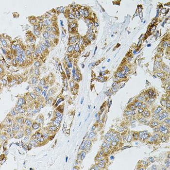 Immunohistochemistry - [KO Validated] SIRT3 Polyclonal Antibody (144-05718)