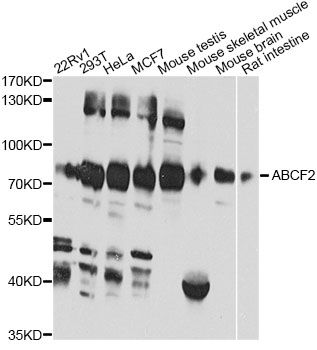 Western blot - ABCF2 antibody (144-012555)