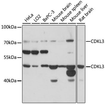 Western blot