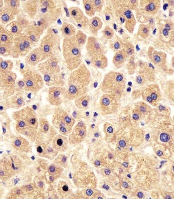 IHC-P