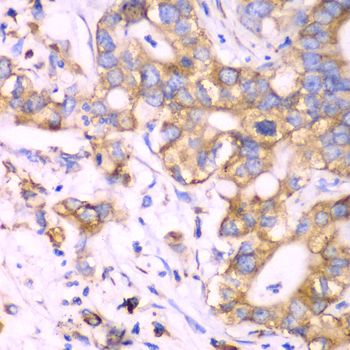 Immunohistochemistry - RPS3A Polyclonal Antibody (144-05885)