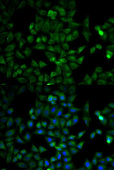 Immunofluorescence - TPI1 antibody (144-02579)